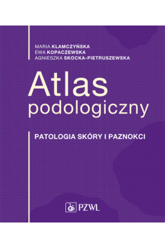 Atlas podologiczny. Patologie skóry i paznokci