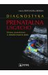 eBook Diagnostyka prenatalna USG/ECHO. Zaburzenia czynnościowe w układzie krążenia płodu mobi epub